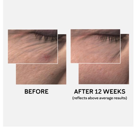 Mary Kay TimeWise Miracle Set 3D Normal / Dry - Picture 5 of 12